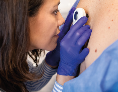 EMOA sensibilise ses équipes au cancer de la peau - EMOA Mutuelle